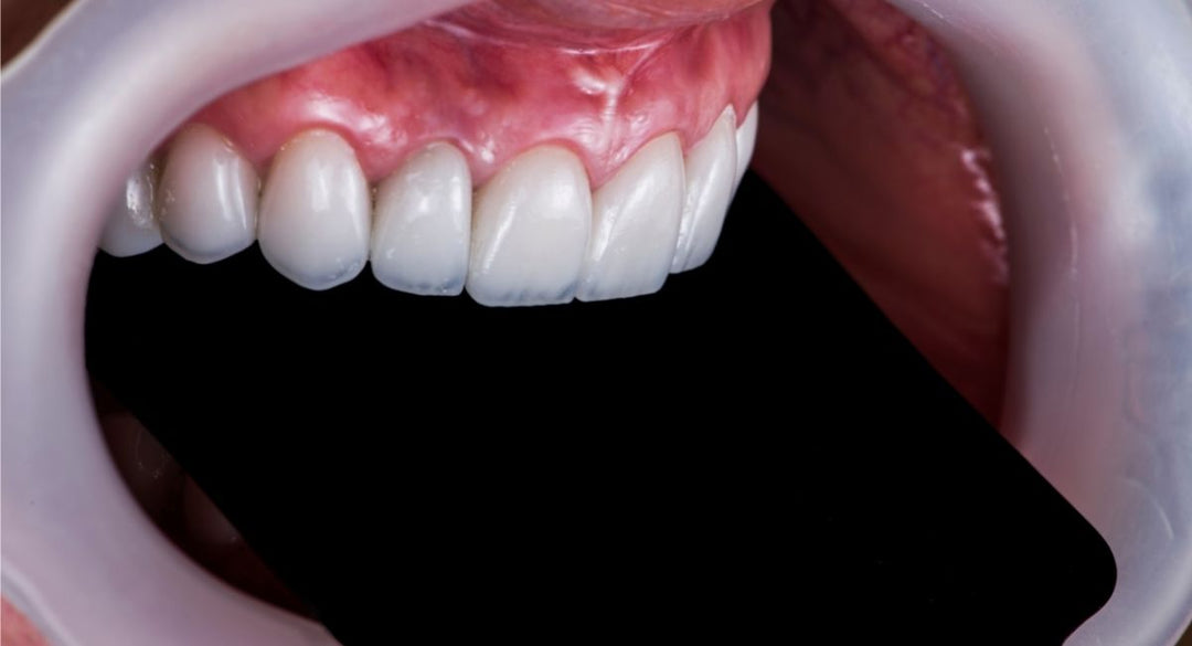 Everything You Need To Know About Dental Photography